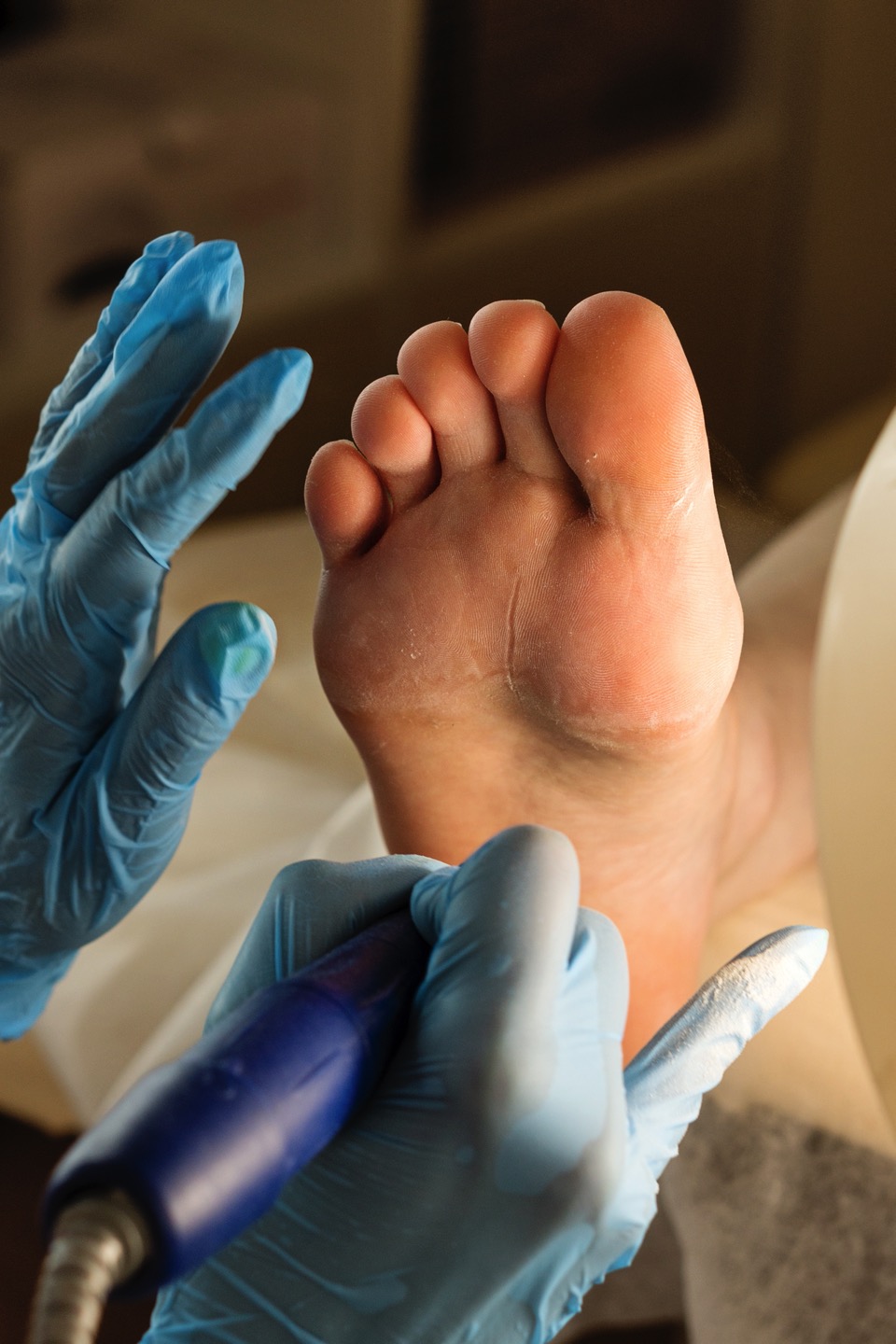 Foot Treatment at Newgate Street Clinic, Worksop
